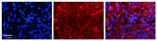 SLC27A6 Antibody in Immunohistochemistry (IHC)