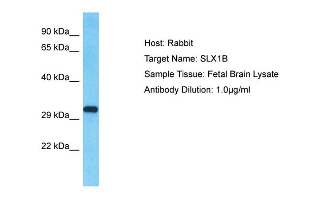 SLX1B Antibody in Western Blot (WB)