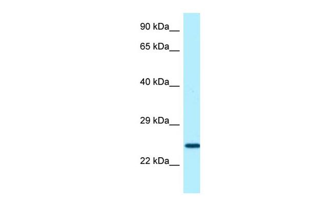 Sostdc1 Antibody in Western Blot (WB)