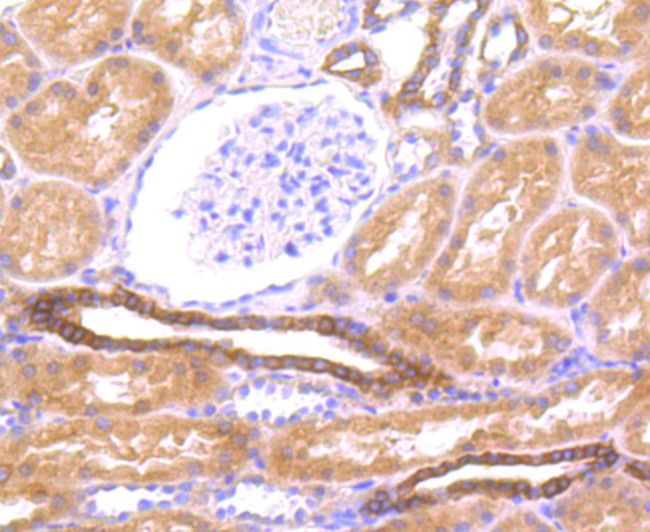 LOX-1 Antibody in Immunohistochemistry (Paraffin) (IHC (P))