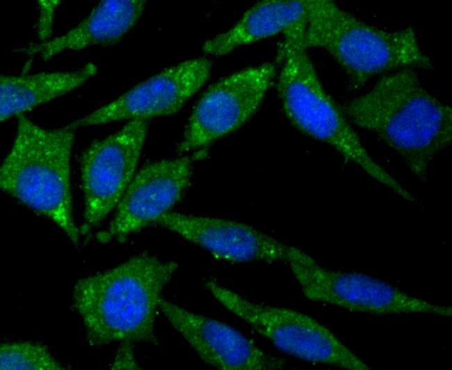 CD21 Antibody in Immunocytochemistry (ICC/IF)