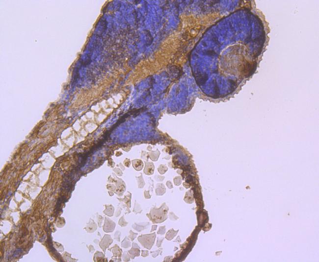 CD127 Antibody in Immunohistochemistry (Paraffin) (IHC (P))