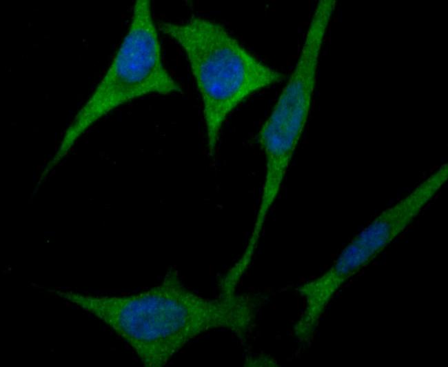 ULK1 Antibody in Immunocytochemistry (ICC/IF)