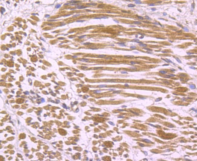 IL-17A Antibody in Immunohistochemistry (Paraffin) (IHC (P))