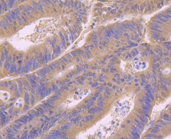 RAB7A Antibody in Immunohistochemistry (Paraffin) (IHC (P))