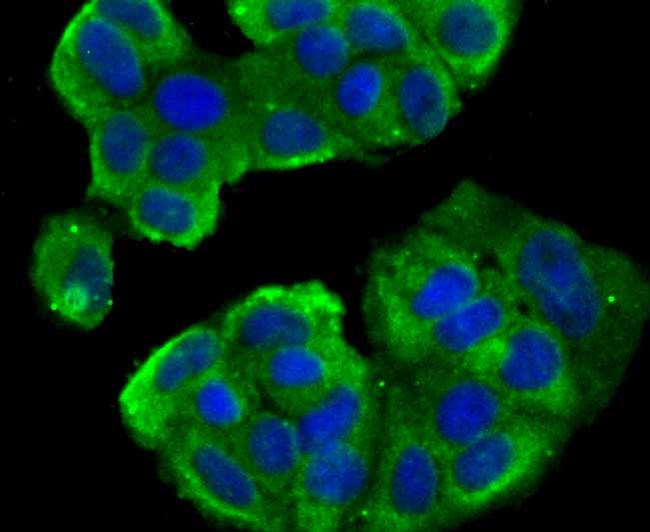 CD266 (TWEAK Receptor) Antibody in Immunocytochemistry (ICC/IF)