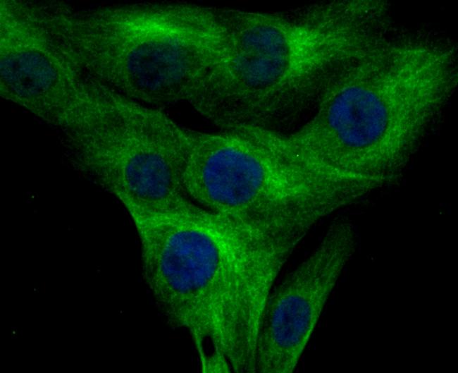 KV4.3 (KCND3) Antibody in Immunocytochemistry (ICC/IF)