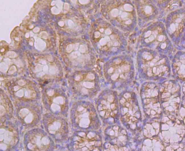 KCNK4 Antibody in Immunohistochemistry (Paraffin) (IHC (P))