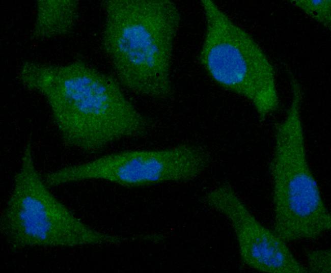 N-WASP Antibody in Immunocytochemistry (ICC/IF)