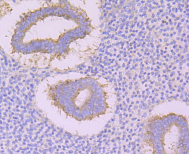 CACNB3 Antibody in Immunohistochemistry (Paraffin) (IHC (P))