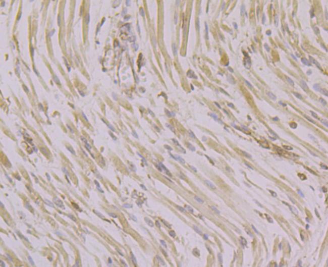 CACNB1 Antibody in Immunohistochemistry (Paraffin) (IHC (P))