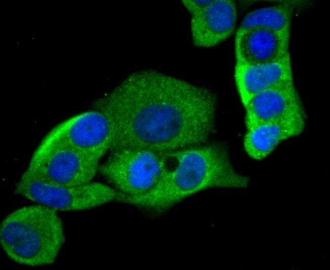 HKDC1 Antibody in Immunocytochemistry (ICC/IF)