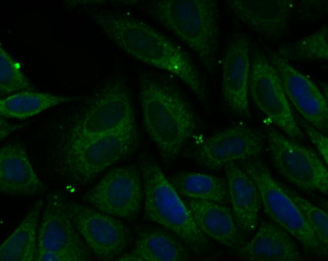 PHF8 Antibody in Immunocytochemistry (ICC/IF)