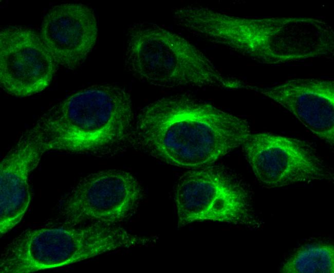 CaV1.2 Antibody in Immunocytochemistry (ICC/IF)