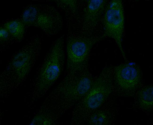 alpha Actinin 1 Antibody in Immunocytochemistry (ICC/IF)