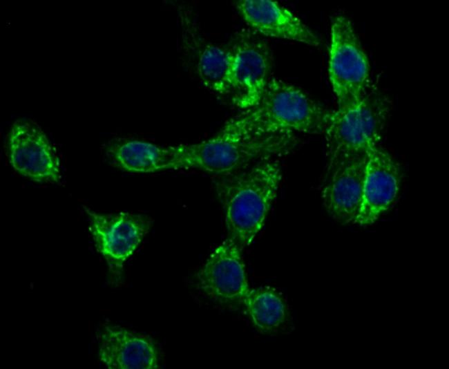 CD99 Antibody in Immunocytochemistry (ICC/IF)