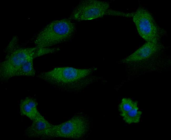 TRPA1 Antibody in Immunocytochemistry (ICC/IF)