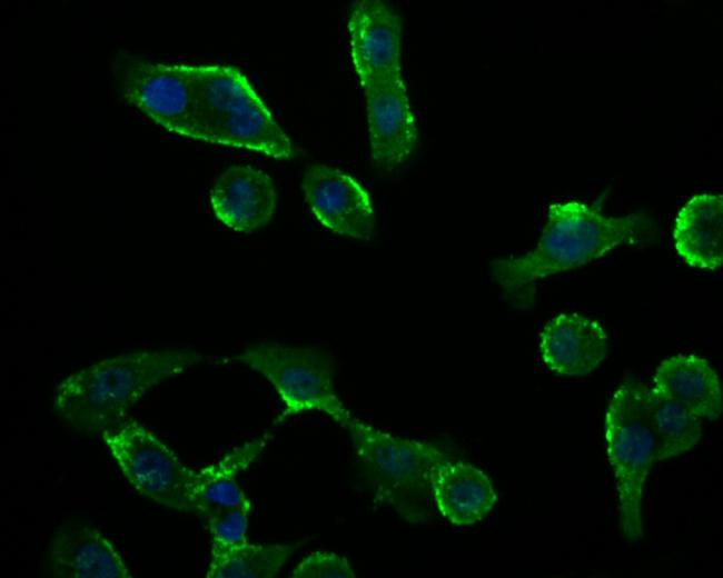 RyR3 Antibody in Immunocytochemistry (ICC/IF)