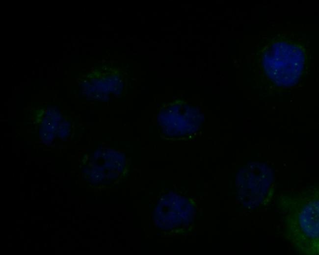 MICA/B Antibody in Immunocytochemistry (ICC/IF)