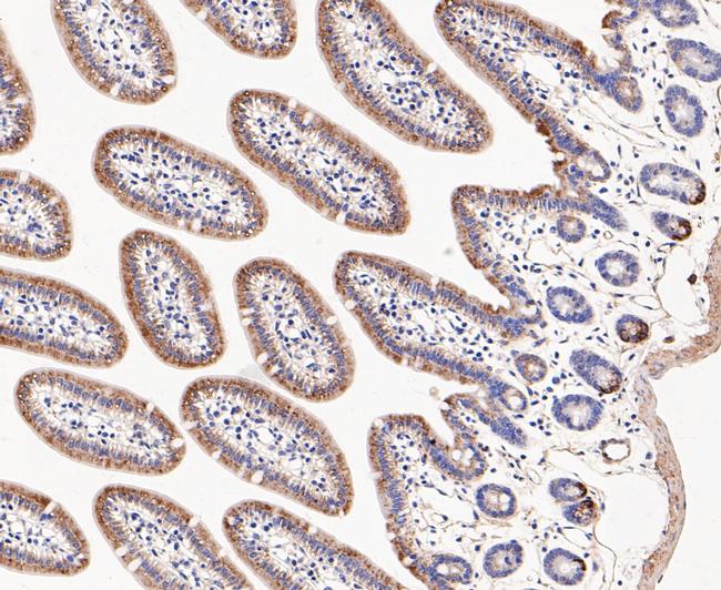 DFNA5 Antibody in Immunohistochemistry (Paraffin) (IHC (P))