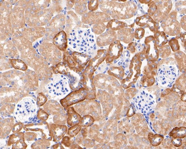 Kir5.1 (KCNJ16) Antibody in Immunohistochemistry (Paraffin) (IHC (P))