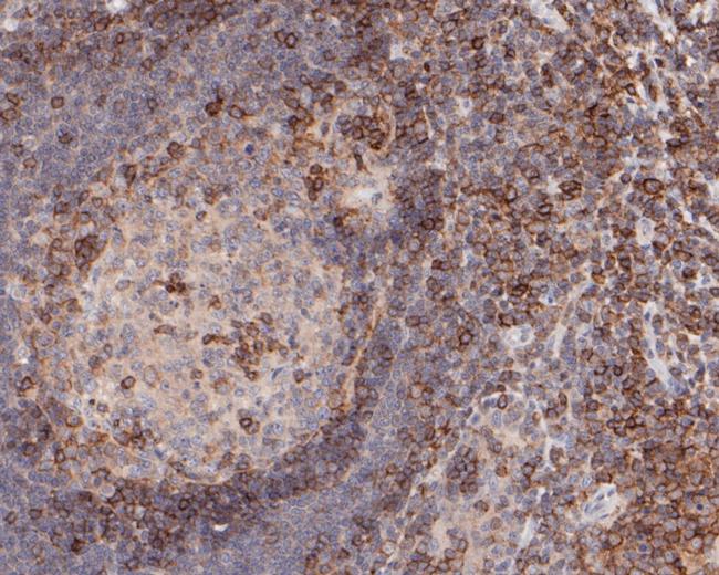 CD43 Antibody in Immunohistochemistry (Paraffin) (IHC (P))