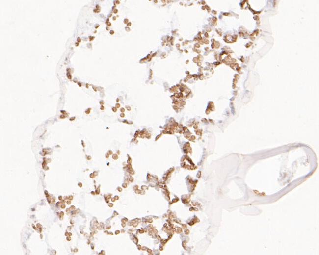 BLOS1 Antibody in Immunohistochemistry (Paraffin) (IHC (P))