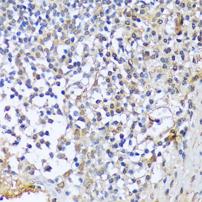 A1CF Antibody in Immunohistochemistry (Paraffin) (IHC (P))