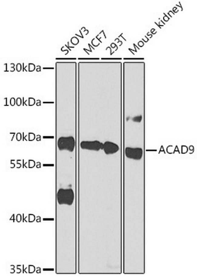 ACAD9 Antibody in Western Blot (WB)