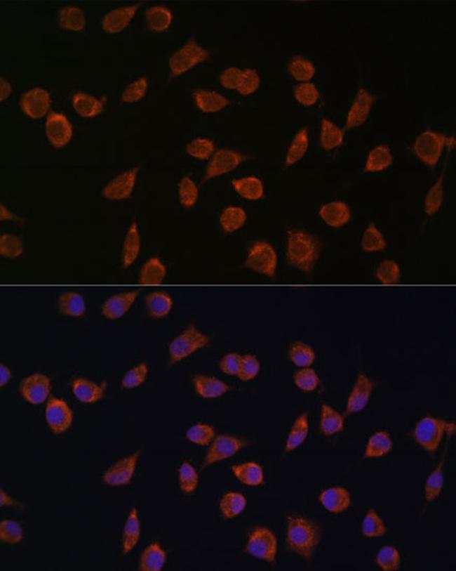 ACSS1 Antibody in Immunocytochemistry (ICC/IF)