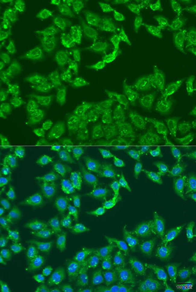 Centaurin alpha-1 Antibody in Immunocytochemistry (ICC/IF)