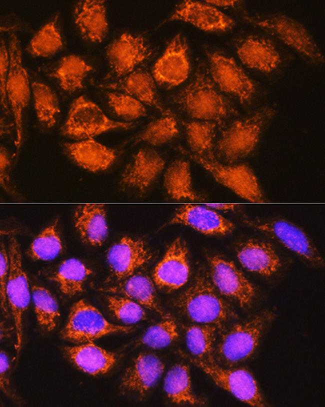 ALDH1B1 Antibody in Immunocytochemistry (ICC/IF)