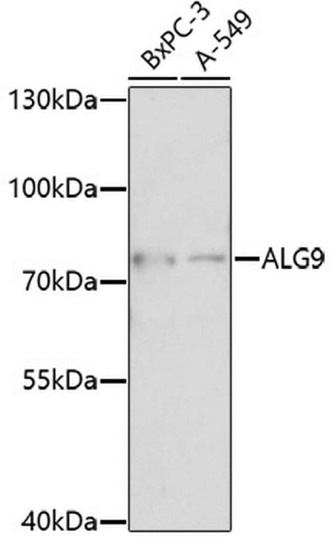 ALG9 Antibody in Western Blot (WB)