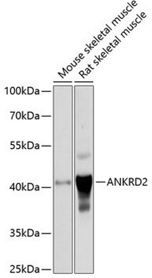 ANKRD2 Antibody in Western Blot (WB)