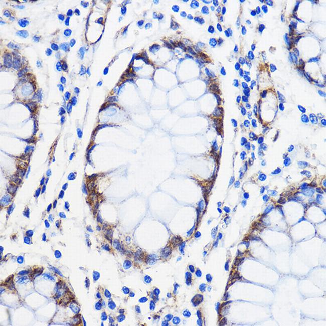 ANT1/ANT2/ANT3/ANT4 Antibody in Immunohistochemistry (Paraffin) (IHC (P))