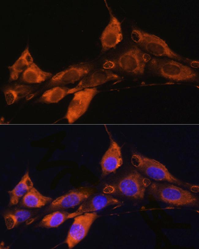 ARF4 Antibody in Immunocytochemistry (ICC/IF)