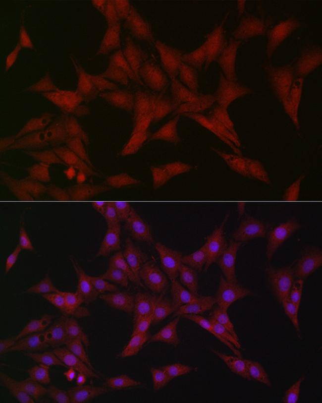 ATF5 Antibody in Immunocytochemistry (ICC/IF)