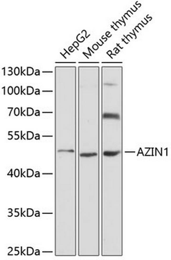 AZIN1 Antibody in Western Blot (WB)