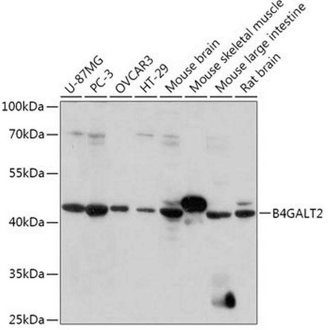 B4GALT2 Antibody in Western Blot (WB)