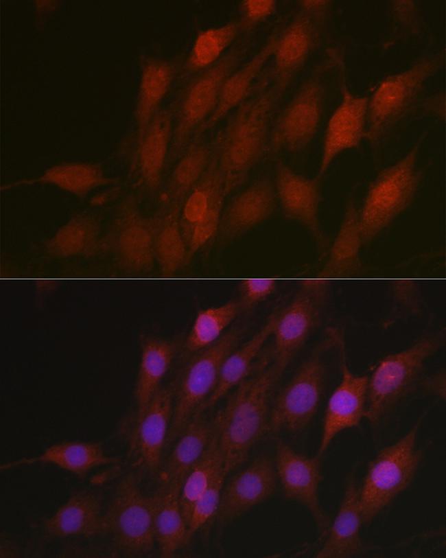 BTRC Antibody in Immunocytochemistry (ICC/IF)