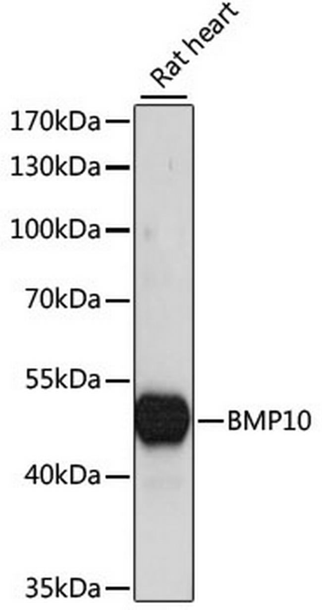 BMP10 Antibody in Western Blot (WB)