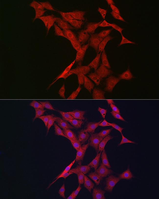 BTRC Antibody in Immunocytochemistry (ICC/IF)