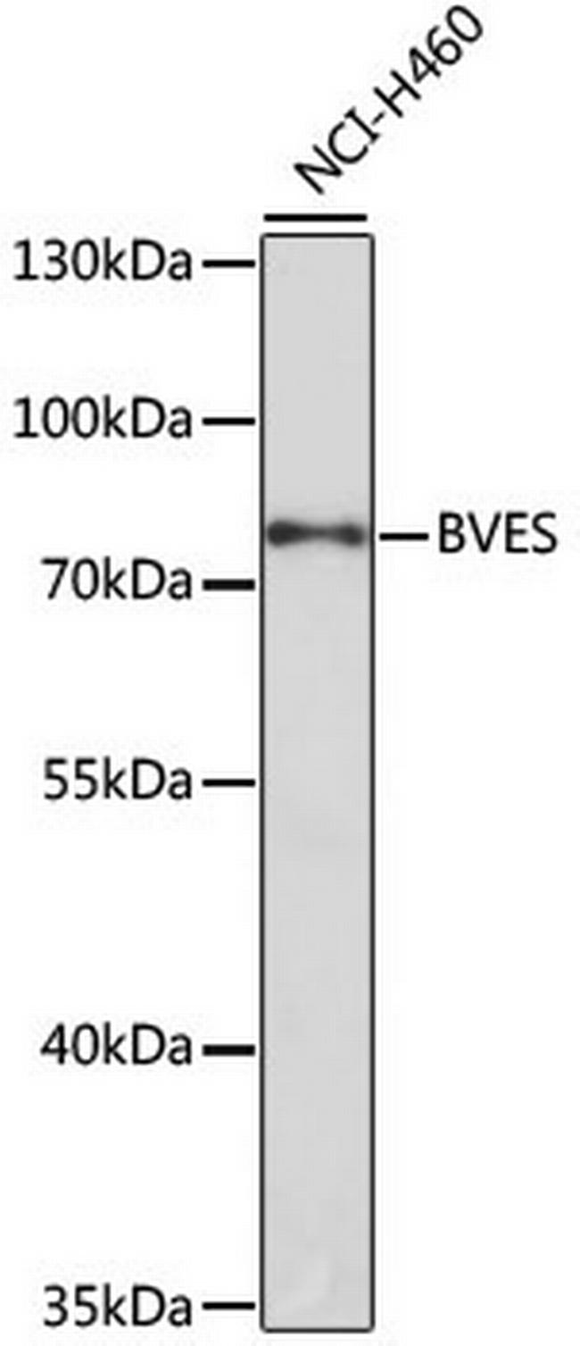 BVES Antibody in Western Blot (WB)