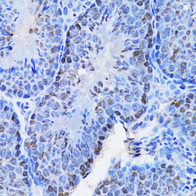 CBX8 Antibody in Immunohistochemistry (Paraffin) (IHC (P))