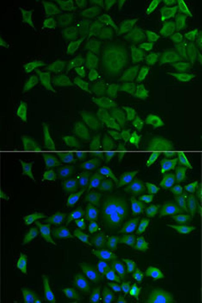 CCBL1 Antibody in Immunocytochemistry (ICC/IF)