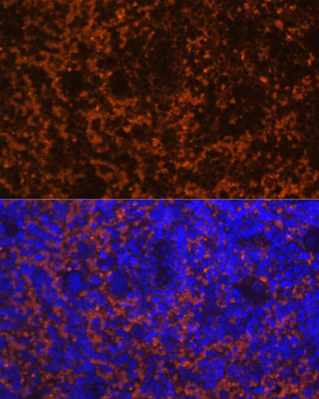 CCL19 Antibody in Immunohistochemistry (Paraffin) (IHC (P))