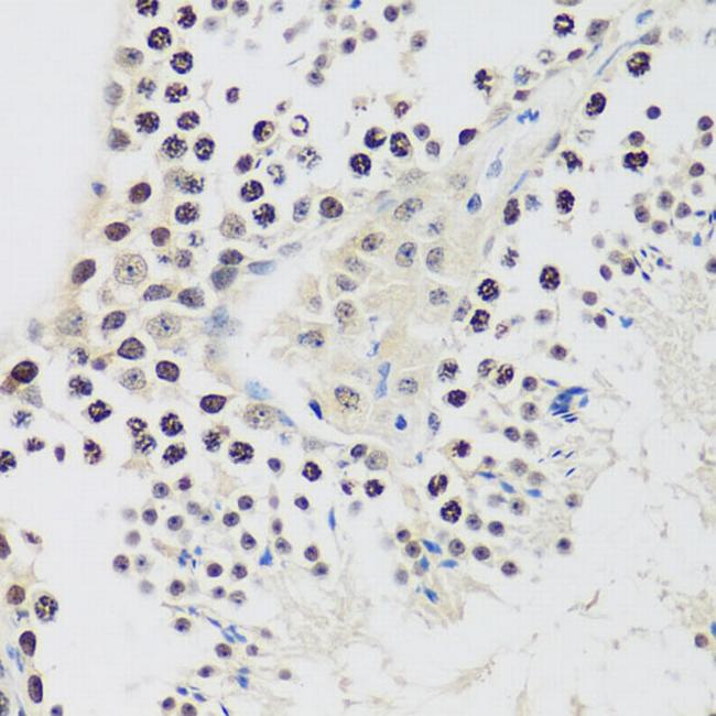 Cyclin E2 Antibody in Immunohistochemistry (Paraffin) (IHC (P))