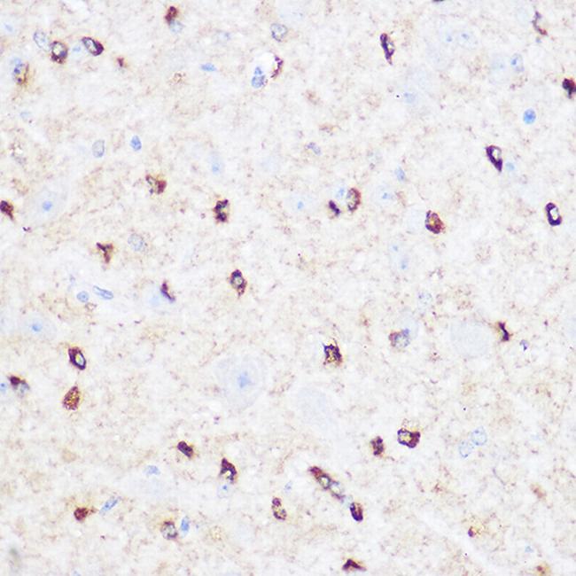 CD47 Antibody in Immunohistochemistry (Paraffin) (IHC (P))