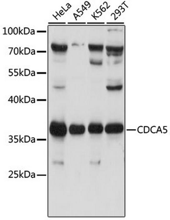 CDCA5 Antibody in Western Blot (WB)