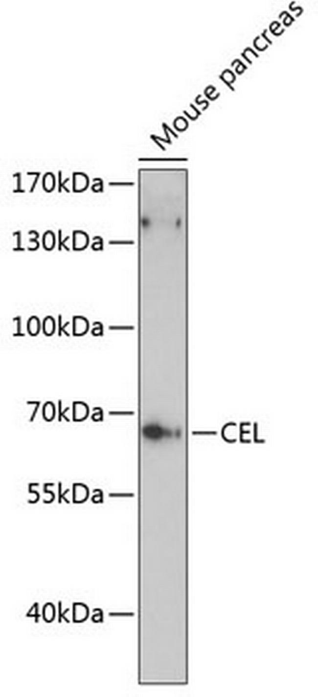 CEL Antibody in Western Blot (WB)